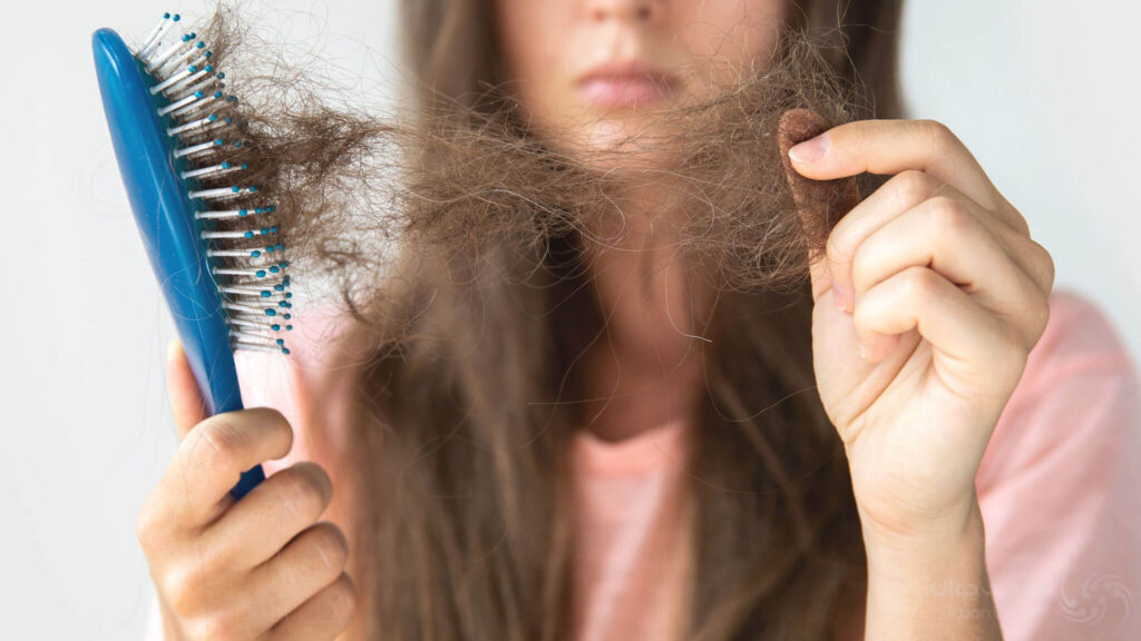 تب بالا ، استرس و عفونت های ویروسی مانند کرونا می توانند باعث ریزش مو شوند.