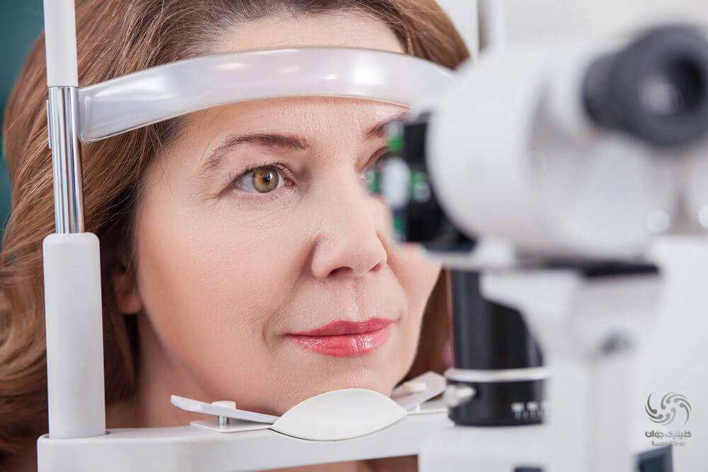 معاینه چشم راه اصلی برای یافتن زودهنگام بیماری تحلیل ماکولای چشم 