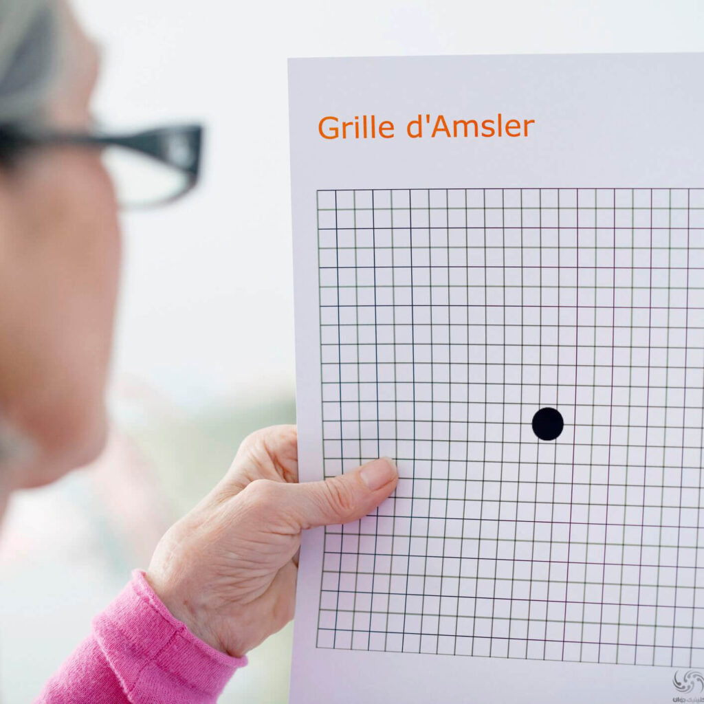 تشخیص تحلیل ماکولای چشم با تست شبکه آمسلر