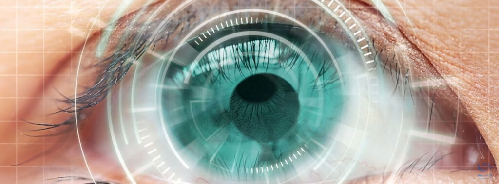 جراحی چشم اسمایل، روش جدیدی برای بر طرف کردن مشکلات بینایی چشم است
