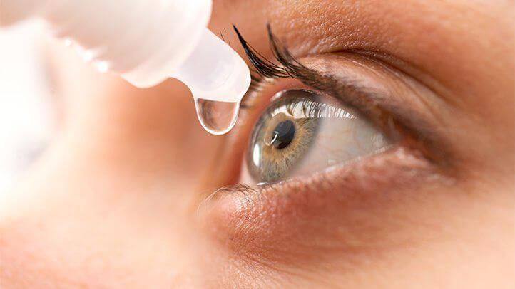 متخصص چشم ممکن است قطره چشم یا کرم پلک برای بهبودی این مشکل برای بیمار تجویز کند.