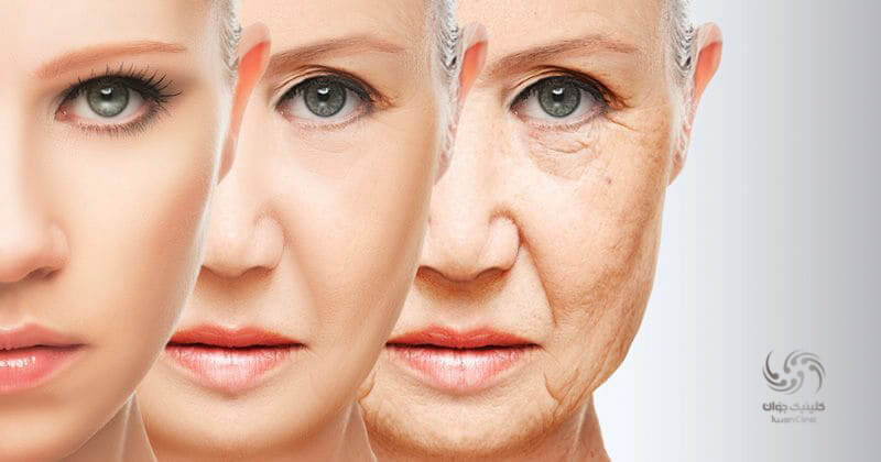 تاثیر افزایش سن بر شکل ظاهری صورت