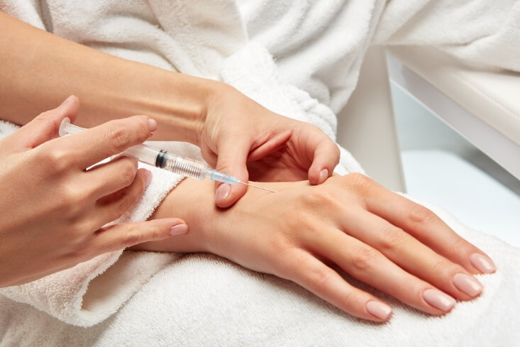 از اسید هیالورونیک و هیدروکسی آپاتایت کلسیم می توان برای پرکردن پوست شل روی دست ها استفاده کرد.