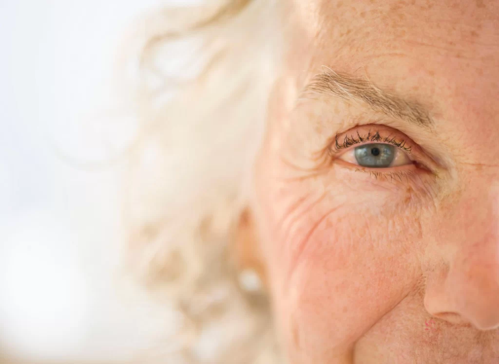 کاتاراکت مرتبط با افزایش سن تمرکز عدسی را برای دید نزدیک تغییر می دهد.