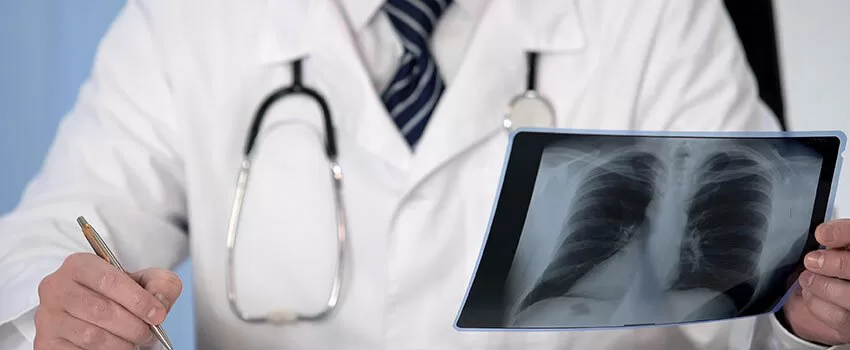 اگر سرفه بیمار برای مدت طولانی ادامه داشته باشد، پزشک برای بررسی دقیق تر رادیوگرافی قفسه سینه را تجویز می کند.